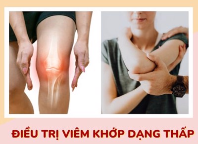 Điều trị viêm khớp dạng thấp và những điều bạn cần biết